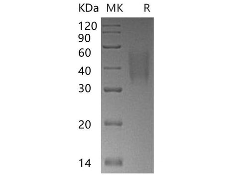 Recombinant Human TRAIL R3/TNFRSF10C Protein (His Tag) - ABMIUM
