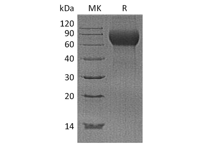 Recombinant Human Hemopexin/HPX Protein (His Tag) - ABMIUM