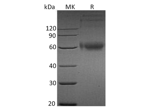 Recombinant Human IL-1RAcP/IL1R3 Protein (His Tag) - ABMIUM