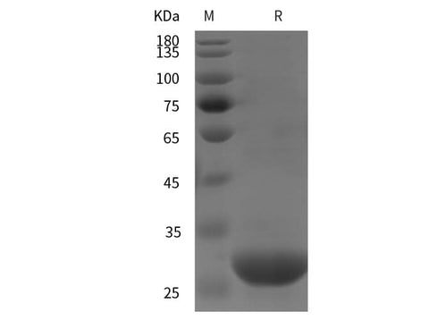 SDS-PAGE analysis of Human Pro-ADM proteins, 2 μg/lane of Recombinant Human Pro-ADM proteins was resolved with SDS-PAGE under reducing conditions, showing bands at 30 kDa.