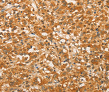 Anti-Human BCL2L14 Antibody - ABMIUM