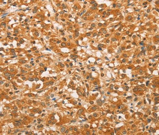 Anti-Human BCL2L14 Antibody - ABMIUM