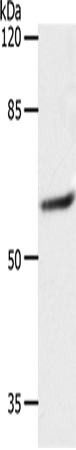 Anti-Human SLC16A4 Antibody - ABMIUM