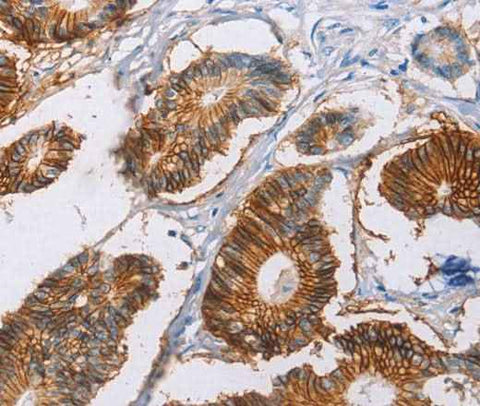 Anti-Human CA9 Antibody
