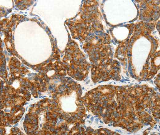 Anti-Human/Mouse/Rat SLC12A4 Antibody
