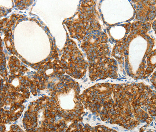Anti-Human/Mouse/Rat SLC12A4 Antibody - ABMIUM