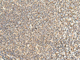 Immunohistochemistry of paraffin-embedded Human tonsil tissue using NEGR1 Polyclonal Antibody at dilution of 1:50(×200)