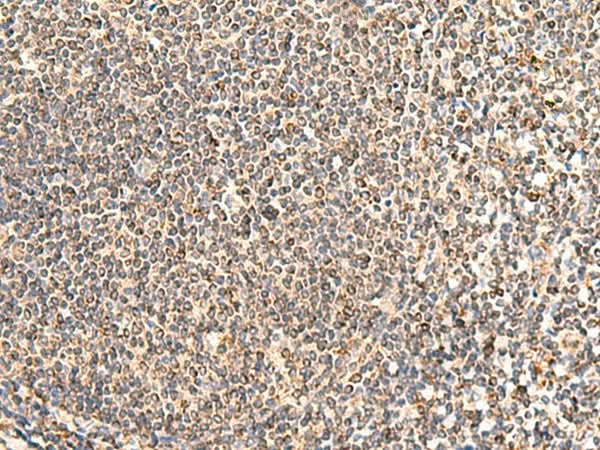 Immunohistochemistry of paraffin-embedded Human tonsil tissue using NEGR1 Polyclonal Antibody at dilution of 1:50(×200)