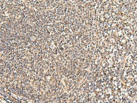 Immunohistochemistry of paraffin-embedded Human tonsil tissue using NEGR1 Polyclonal Antibody at dilution of 1:50(×200)