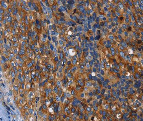 Anti-Human MSLN Antibody