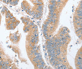 Anti-Human/Mouse/Rat PARD6A Antibody - ABMIUM