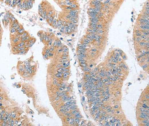 Anti-Human/Mouse/Rat PARD6A Antibody