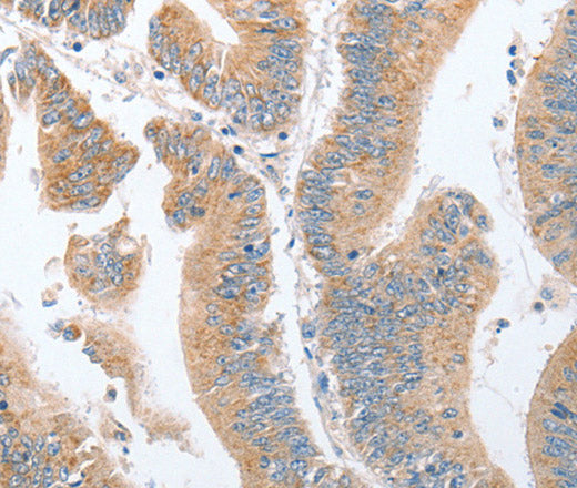Anti-Human/Mouse/Rat PARD6A Antibody - ABMIUM