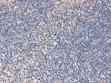 Immunohistochemistry of paraffin-embedded Human tonsil tissue using INPP5B Polyclonal Antibody at dilution of 1:40(×200)