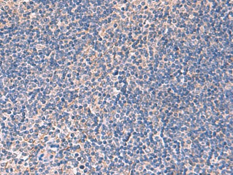 Immunohistochemistry of paraffin-embedded Human tonsil tissue using INPP5B Polyclonal Antibody at dilution of 1:40(×200)