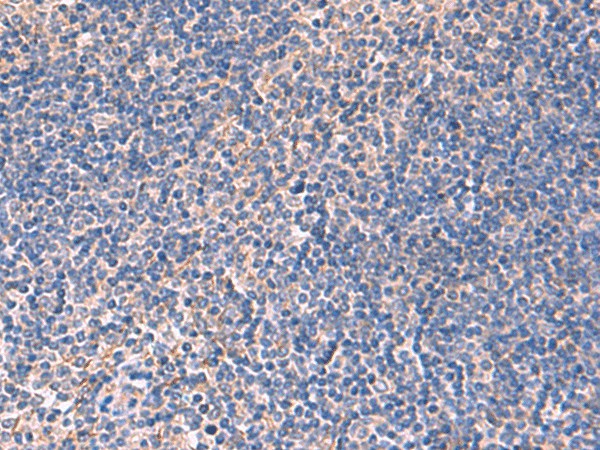 Immunohistochemistry of paraffin-embedded Human tonsil tissue using INPP5B Polyclonal Antibody at dilution of 1:40(×200)