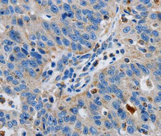 Anti-Human/Mouse/Rat GRIA3 Antibody