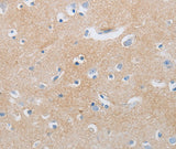 Anti-Human/Mouse/Rat MME Antibody - ABMIUM