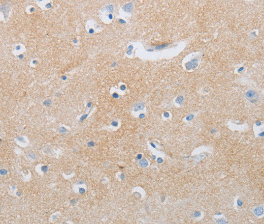 Anti-Human/Mouse/Rat MME Antibody - ABMIUM