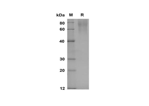 SDS-PAGE analysis of Rat CEACAM1/CD66a proteins, 2 μg/lane of Recombinant Rat CEACAM1/CD66a proteins was resolved with SDS-PAGE under reducing conditions, showing bands at 60-80 kDa.