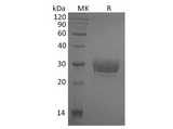 Recombinant Human CD32a/FCGR2A Protein (H131, His Tag) - ABMIUM