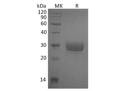 Recombinant Human CD32a/FCGR2A Protein (H131, His Tag) - ABMIUM