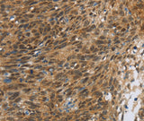 Anti-Human/Mouse FOXB1 Antibody - ABMIUM