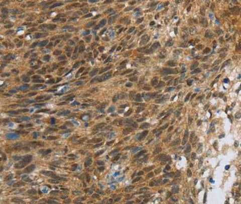Anti-Human/Mouse FOXB1 Antibody