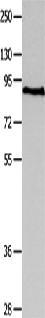 Anti-Human/Mouse/Rat MAGED1 Antibody - ABMIUM