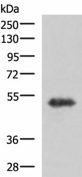 Western blot analysis of Human fetal brain tissue lysate using TSEN2 Polyclonal Antibody at dilution of 1:1000