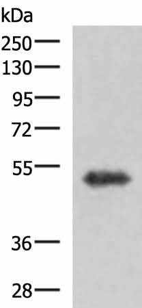Western blot analysis of Human fetal brain tissue lysate using TSEN2 Polyclonal Antibody at dilution of 1:1000