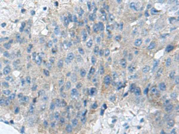 Anti-Human/Mouse KIAA0556 Antibody