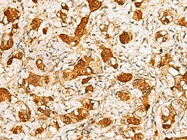 Anti-Human/Mouse/Rat C11orf54 Antibody