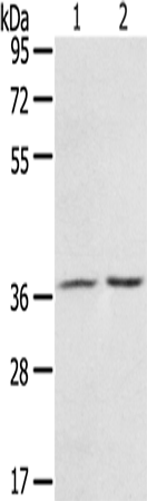 Anti-Human/Mouse/Rat PDLIM4 Antibody - ABMIUM
