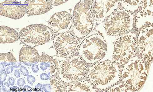 Anti-Human/Mouse/Rat/Monkey SMAD4 Antibody