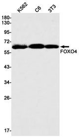 Western blot detection of FOXO4 in K562,C6,3T3 cell lysates using FOXO4 Rabbit mAb(1:1000 diluted).Predicted band size:54kDa.Observed band size:65kDa.