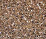 Anti-Human HIF1A Antibody - ABMIUM