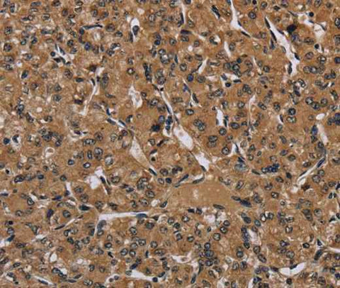 Anti-Human HIF1A Antibody
