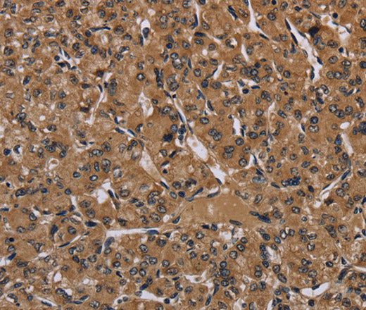 Anti-Human HIF1A Antibody - ABMIUM