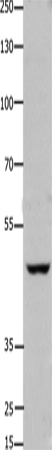 Anti-Human/Mouse FOXD3 Antibody - ABMIUM