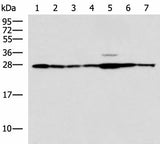 Western blot analysis of Rat liver tissue Mouse kidney tissue Mouse lung tissue HUVEC Jurkat Hela HepG2 cell lysates using RPL10A Polyclonal Antibody at dilution of 1:700