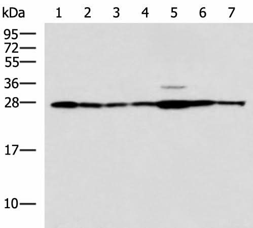 Western blot analysis of Rat liver tissue Mouse kidney tissue Mouse lung tissue HUVEC Jurkat Hela HepG2 cell lysates using RPL10A Polyclonal Antibody at dilution of 1:700