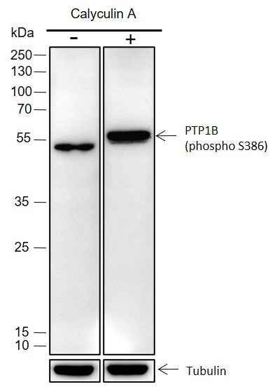 Anti-Human Phospho-PTP1B (Ser386) Antibody [A346] - ABMIUM
