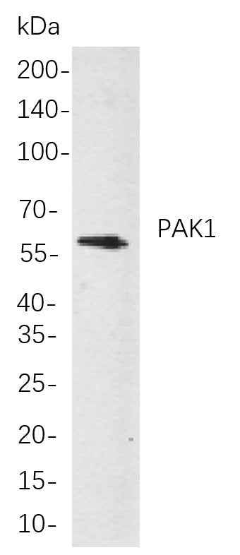 Anti-Human/Mouse/Rat PAK1 Antibody [B857] - ABMIUM