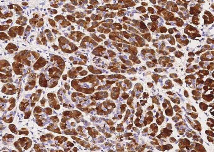 Anti-Human CLPS Antibody [B189] - ABMIUM