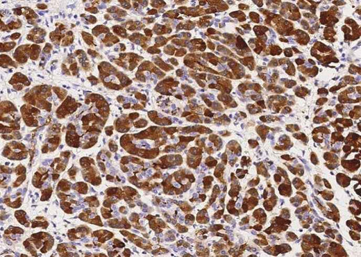 Anti-Human CLPS Antibody [B189] - ABMIUM