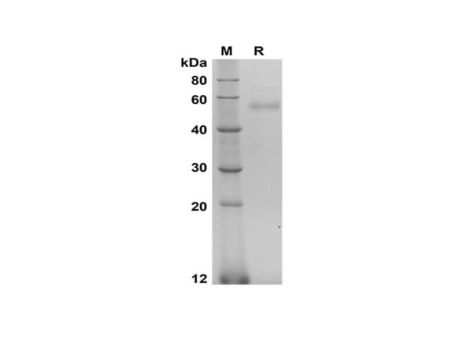 SDS-PAGE analysis of Human HYAL1 proteins, 2 μg/lane of Recombinant Human HYAL1 proteins was resolved with SDS-PAGE under reducing conditions, showing bands at 50-60 kDa.