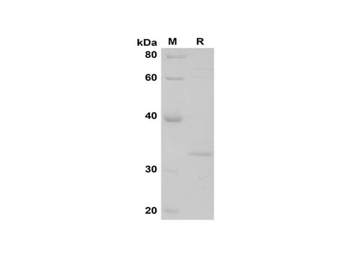 SDS-PAGE analysis of Mouse IFABP proteins, 2 μg/lane of Recombinant Mouse IFABP proteins was resolved with SDS-PAGE under reducing conditions, showing bands at 34 kDa.