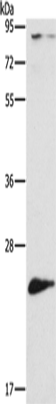 Anti-Human/Mouse ATG10 Antibody - ABMIUM