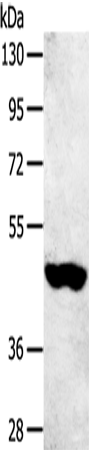 Anti-Human SULT2B1 Antibody - ABMIUM